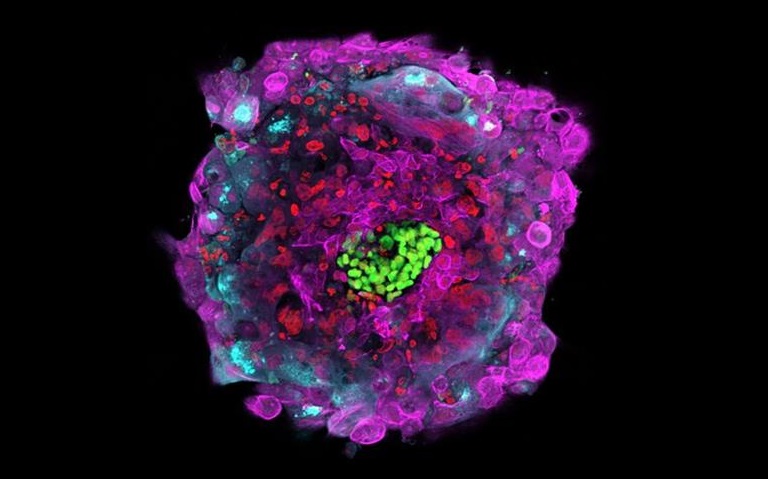Human embryo on day 12 from in vitro fertilization. Rockefeller University.