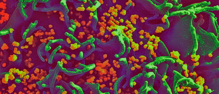 HIV-Proof for 6 Months: New Treatment Provides Long-Term Protection