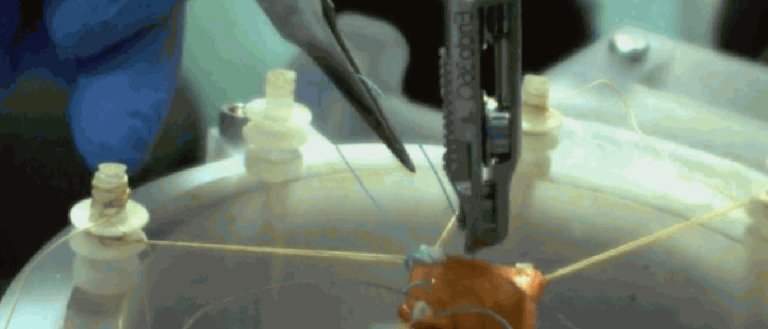 A New Surgical Robot Just Outdid Human Surgeons