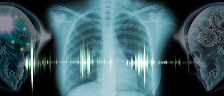Watch Out, Doc. An AI is Going to Start Interpreting X-Rays