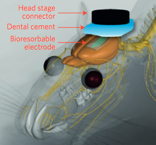Illustration of the "bioresorbable" electrodes implanted in a rat's brain. Credit: Ki Jun Yu et al./Nature Materials