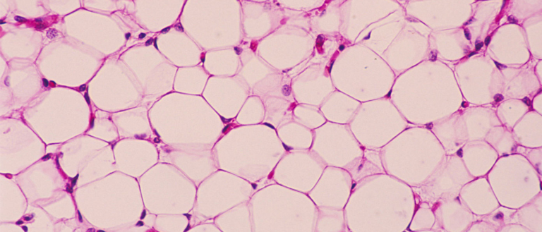 Antiobesity Drugs In Nanoparticles Target Fat Cells Like Missiles