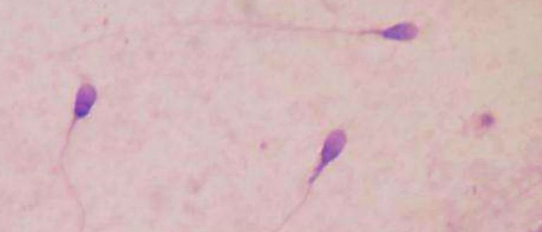 Scientists Created Sperm from Human Skin Cells