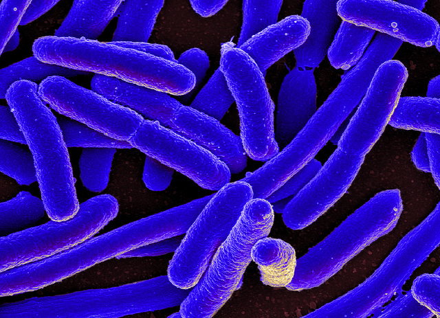 E. coli bacteria