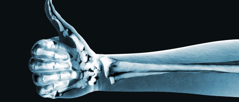 A New Company Is Trying to Grow Human Bones From Fat Cells