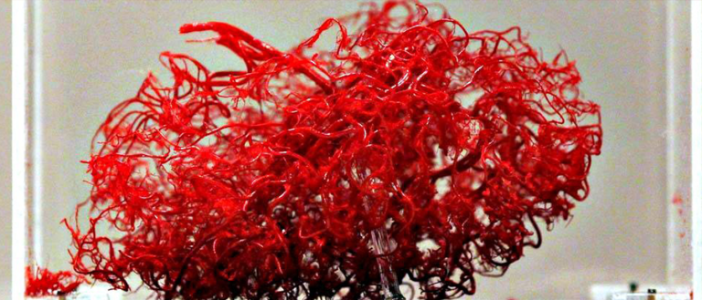 Scientists Claim They’ve Developed Aspirin that Crosses the Blood-Brain Barrier