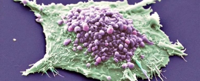 Scientists Are Closer To The First ‘Universal Cancer Vaccine” With Successful Human Trials