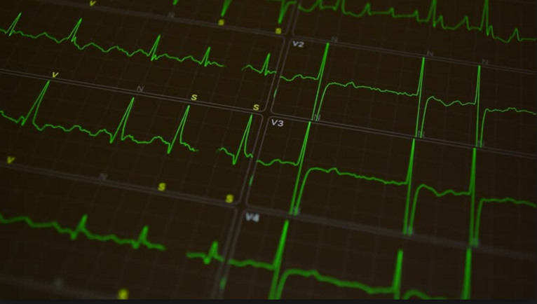 New Tech Measures Your Pulse and Breath Without Ever Touching Your Body