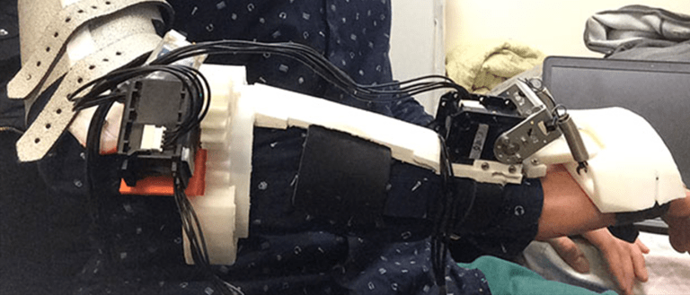 Lightweight Exoskeleton Being Developed to Treat Parkinson’s Tremors