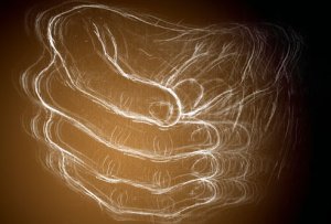 Artist depiction of tremor Credit: WebMD