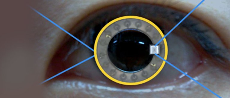 Scientists Created Smart Contacts That Can Monitor and Treat Diabetes