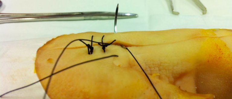 New ‘Smart’ Sutures Send Recovery Info From Your Wound to Your Cell Phone