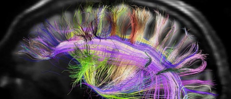 Scientists: Brain Stimulation May Make You Smarter But At a Huge Cost