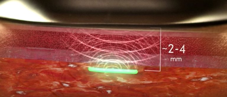 These Biosensors Could Let Us Monitor The Health of Soldiers in Combat