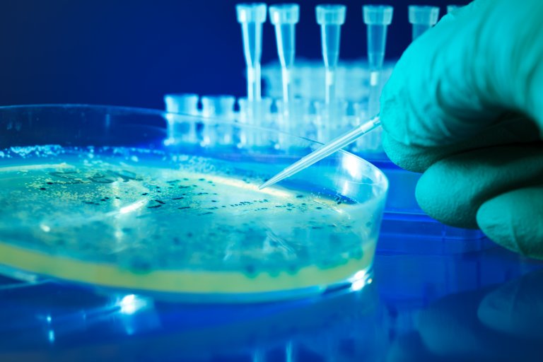 New Stem Cell Transplant May Halt Multiple Sclerosis but It Comes at a Cost