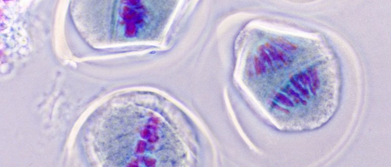 Scientists Have Pinpointed the Gene Responsible for Down Syndrome