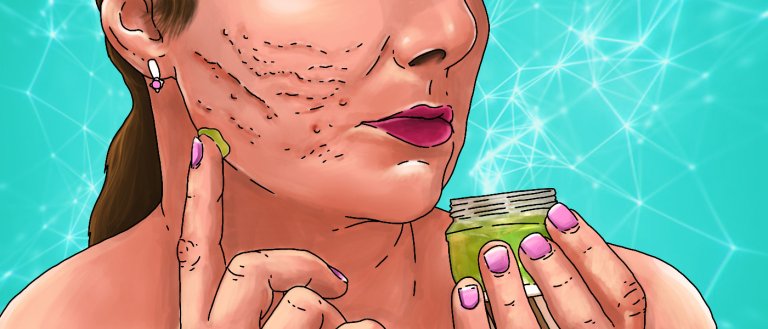 We May Finally Have A Way To Stop Scars From Ever Forming