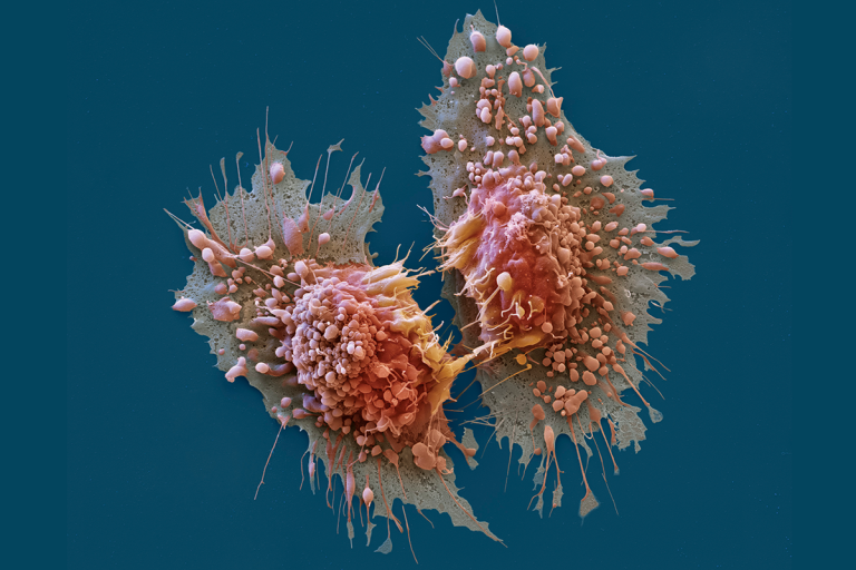 AI Saves Woman’s Life By Identifying Her Disease When Other Methods (humans) Failed