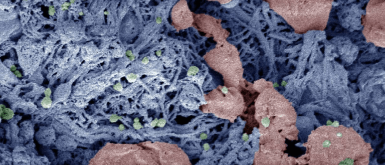Revolutionary Injectable Nanoparticles Can Help Stop Internal Bleeding