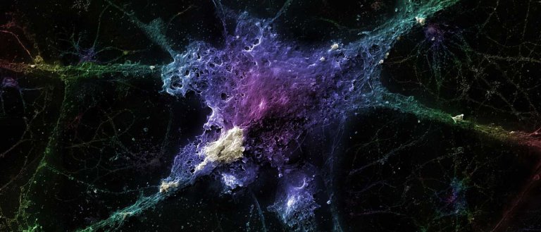We Just Moved One Step Closer to Understanding (and Defeating) Alzheimer’s