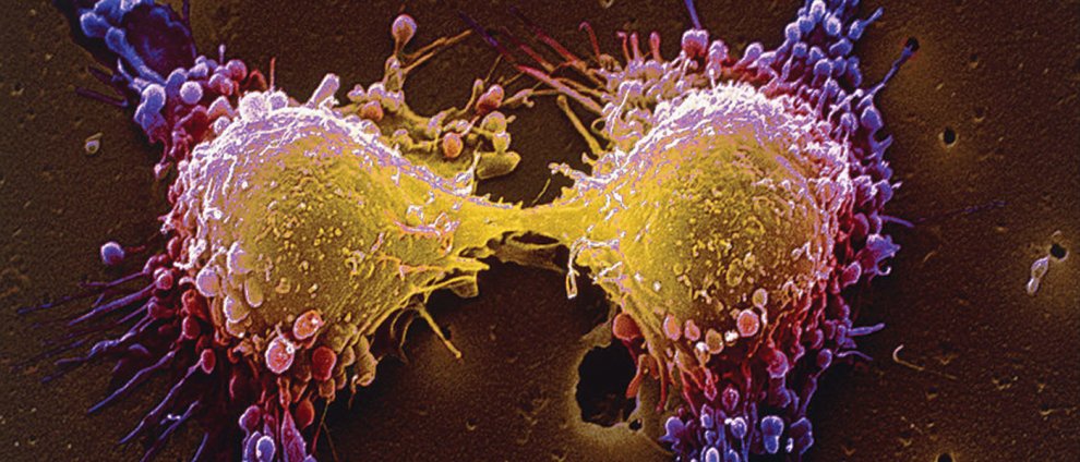 Changing The Properties of DNA: Scientists Have a New Way to Fight Cancer
