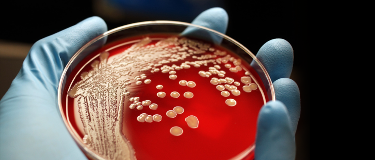 Unprecedented Rise in “Superbugs” Prompts U.N. General Assembly Meeting