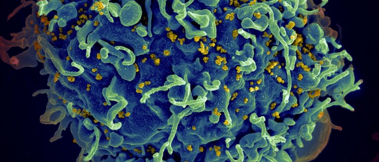 hiv crispr-cas9 gene editing hiv cure