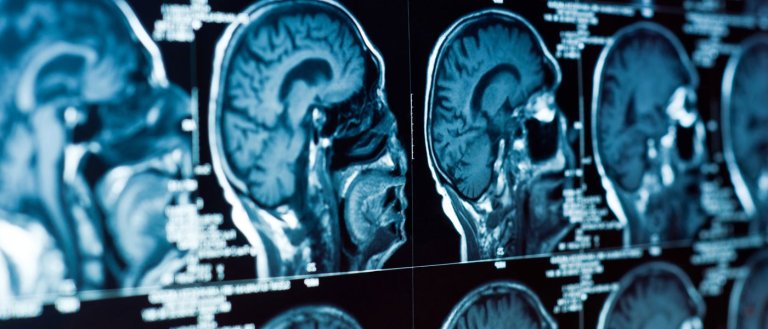 Not Just a State of Mind: Scientists Locate the Physical Source of Depression in the Brain