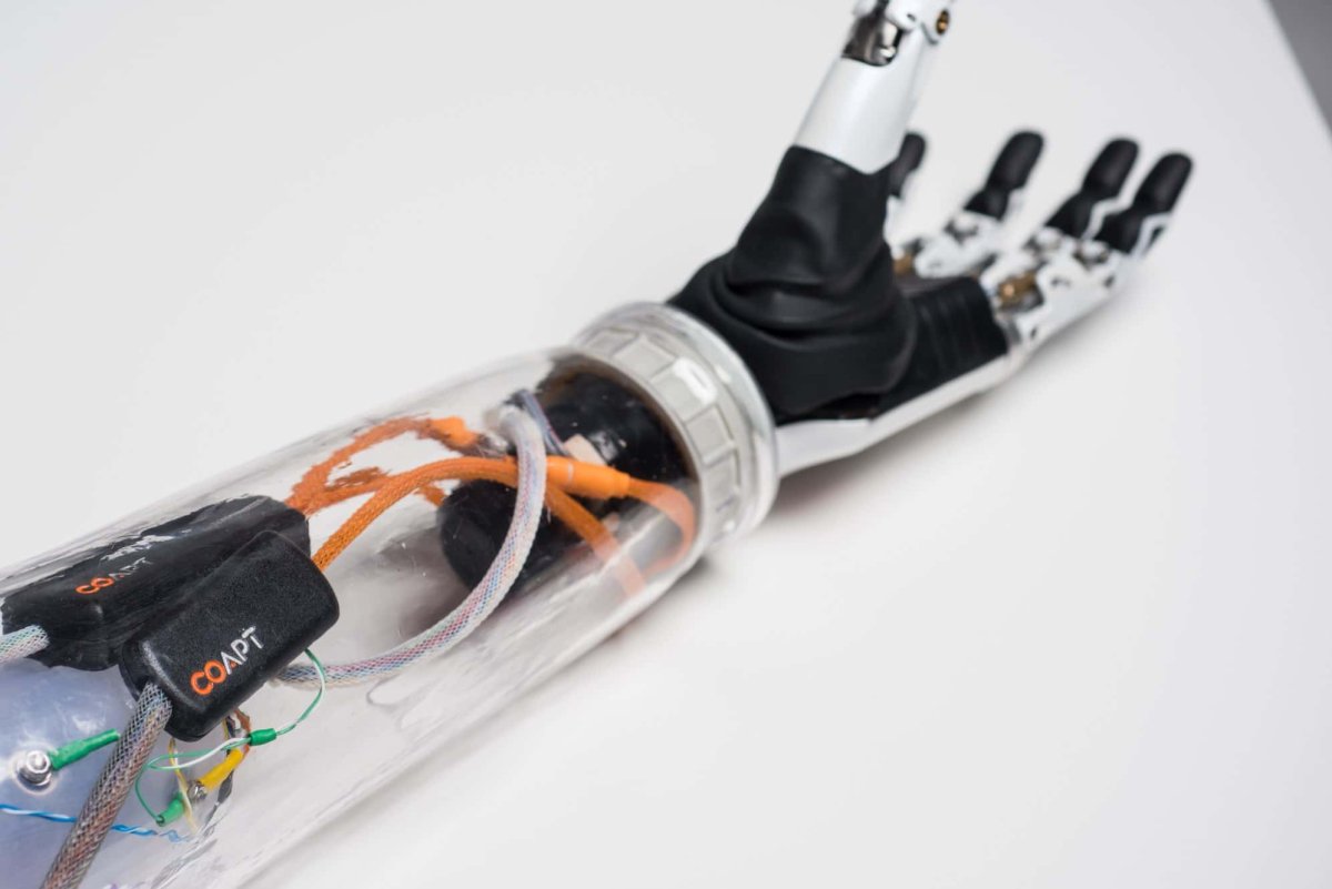 Alien Bionic Tech Mind-Controlled Bionics: New Tech Translates Thoughts Into Motion