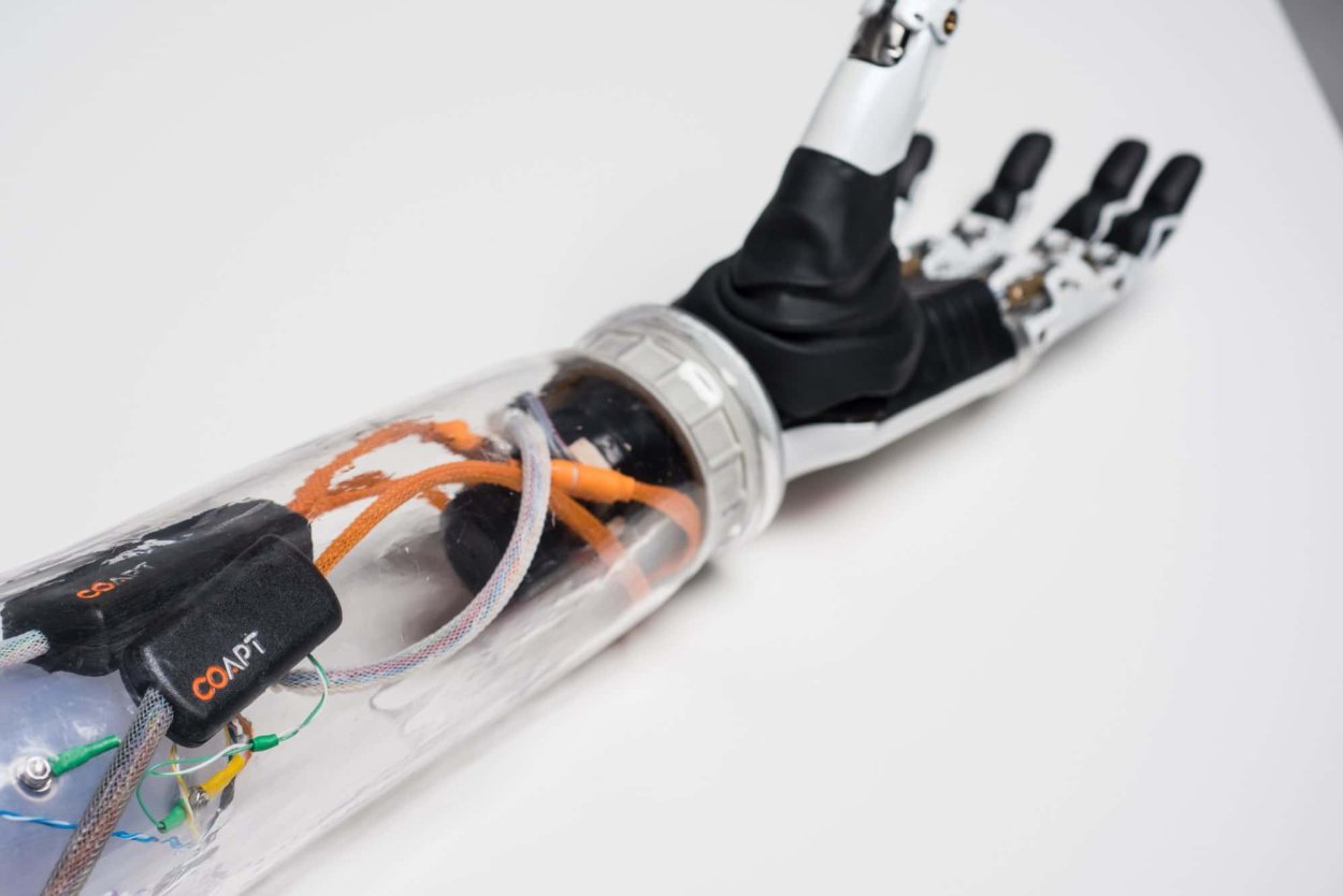 Mind-Controlled Bionics: New Tech Translates Thoughts Into Motion
