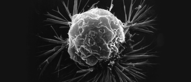 Genetics Breakthrough Could Give Us a Way to Target and Kill Cancer