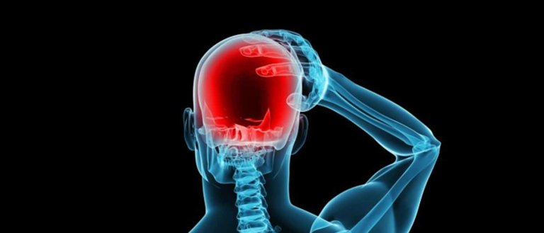 Migraines Linked to Permanent Changes in Brain Structure