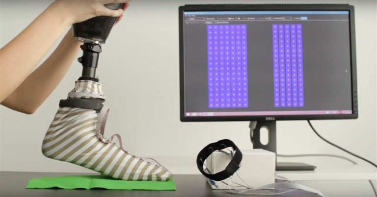 This Sock Grants Sensation to Prosthetic Feet
