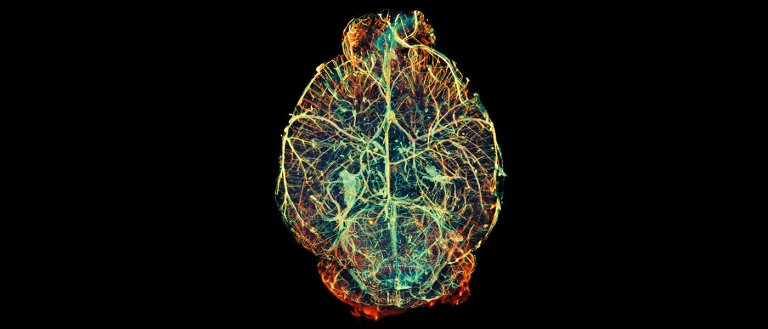 Manipulating One Brain Protein Could Allow Us to Prevent Alzheimer’s