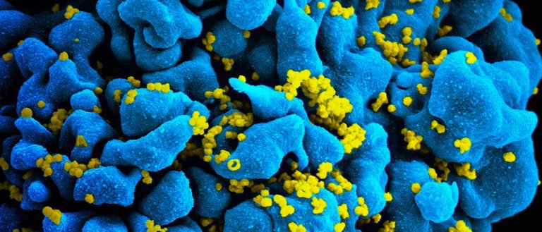 Newly Discovered Antibody Can Neutralize 98 Percent of HIV Strains