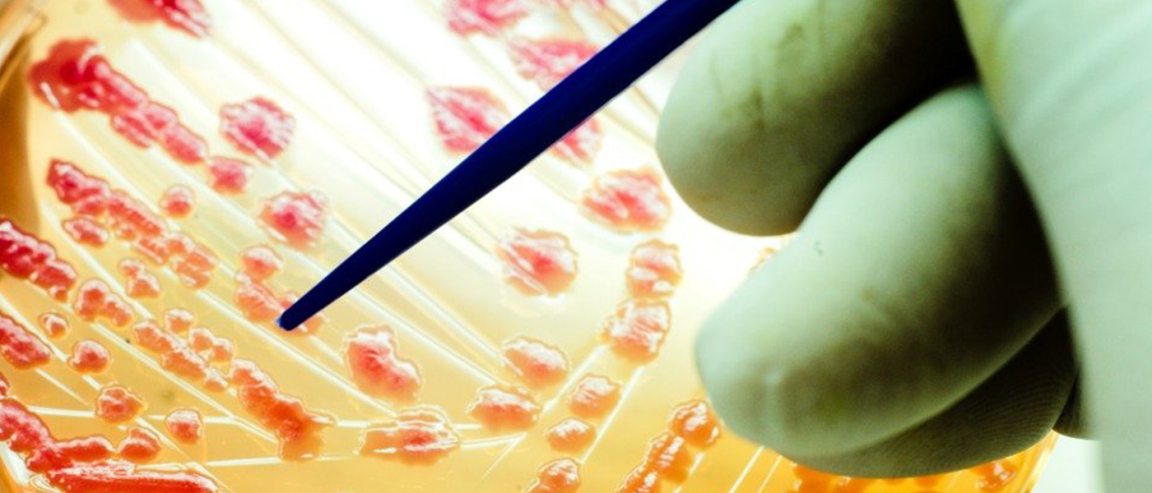 antibiotic resistance antibiotics resistant pathogens