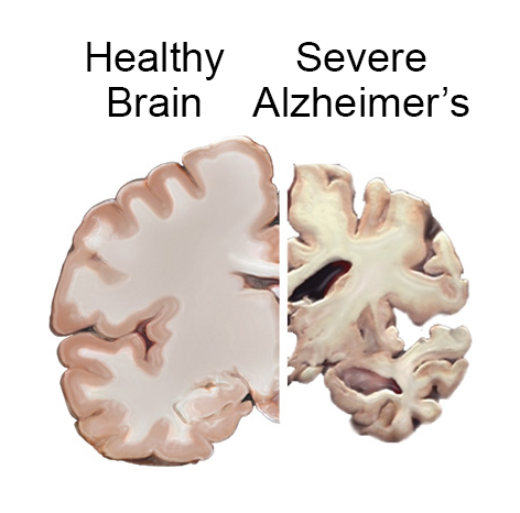 Credit:NIH-NIA