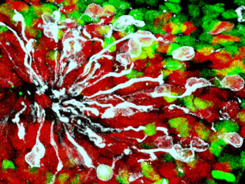This image is from lab-grown brain tissue — a minibrain — infected by Zika virus (white) with neural stem cells in red and neuronal nuclei in green. Courtesy of Xuyu Qian and Guo-li Ming