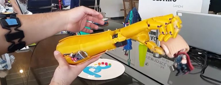 Welcome to a World That Prints Prosthetic Limbs