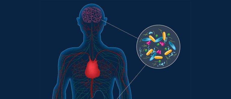 Parkinson’s May Actually Originate From Microbes in the Gut