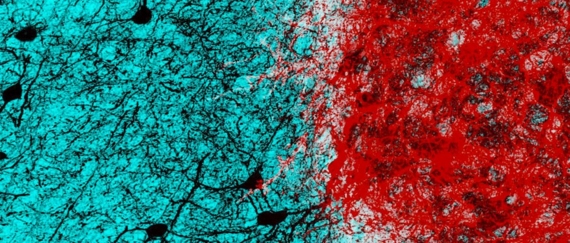 interneurons fear biology