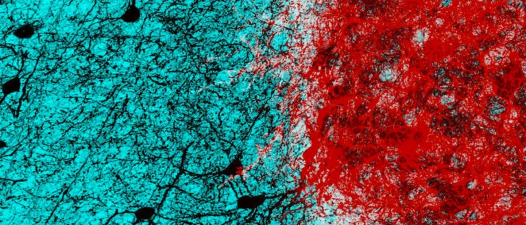 interneurons fear biology