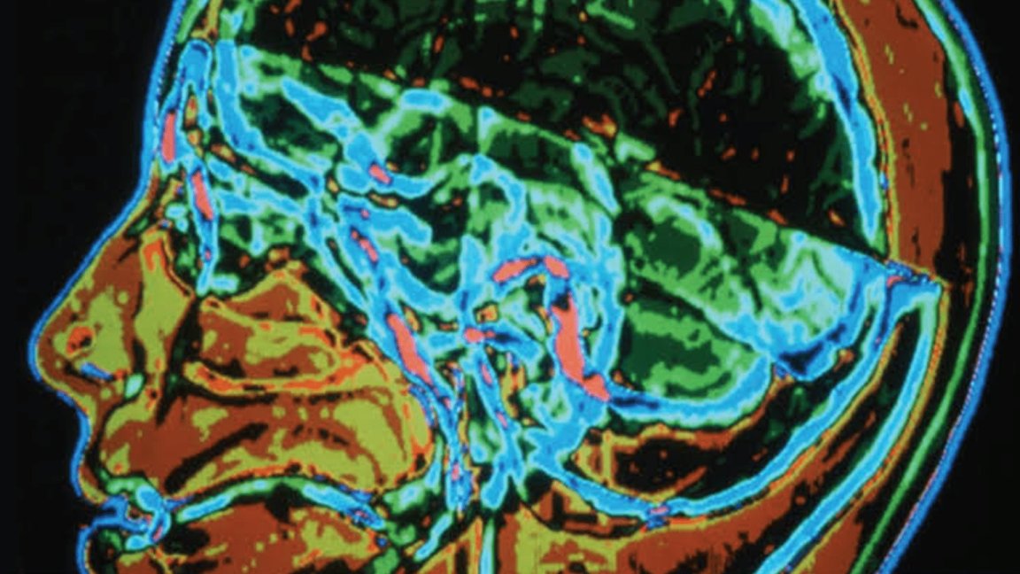 alzheimer's disease neuroscience alzheimer's treatment