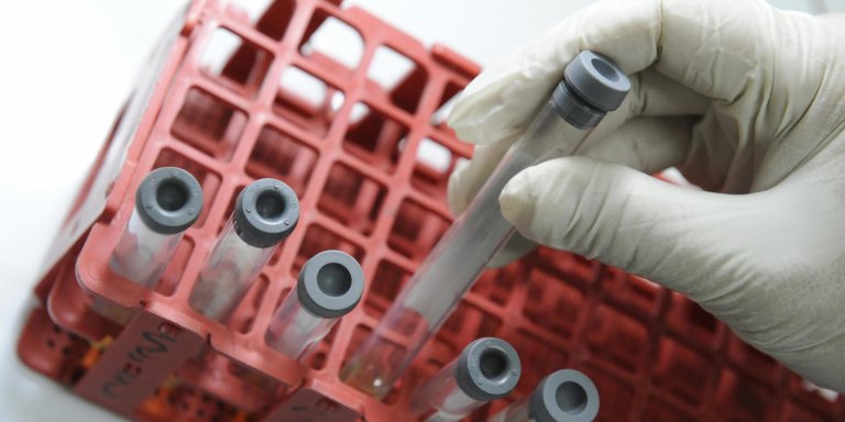 A Revolutionary HIV Vaccine Is Going to Be Tested on 600 People Next Year