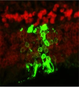 blindness pharmaceutical science stem cell therapy