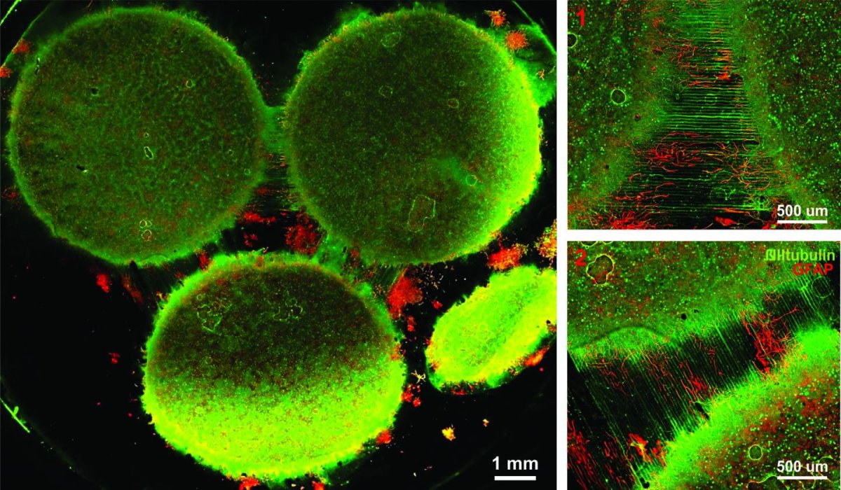 Image of the in vitro model showing three distinct regions of the brain connected by axons. CREDIT: Disease Biophysics Group/Harvard University