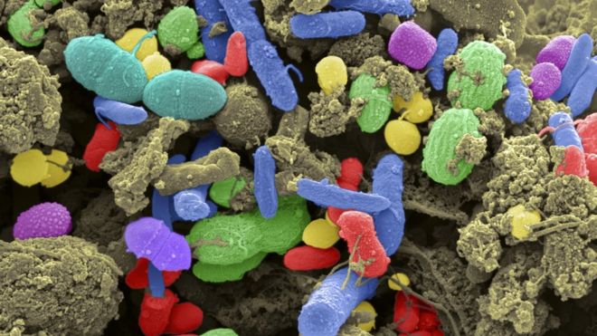 Image source: SCIENCE PHOTO LIBRARY