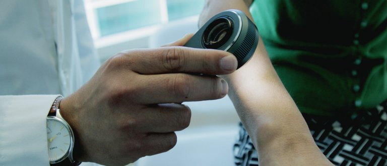 AI Can Identify Skin Cancer As Well As Doctors