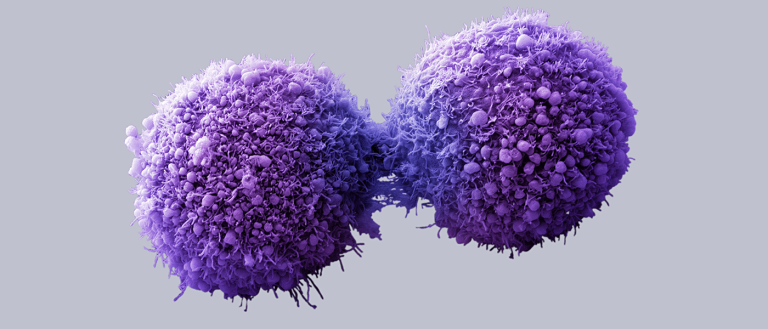 Cancer Deaths Have Dropped 25% in 20 Years