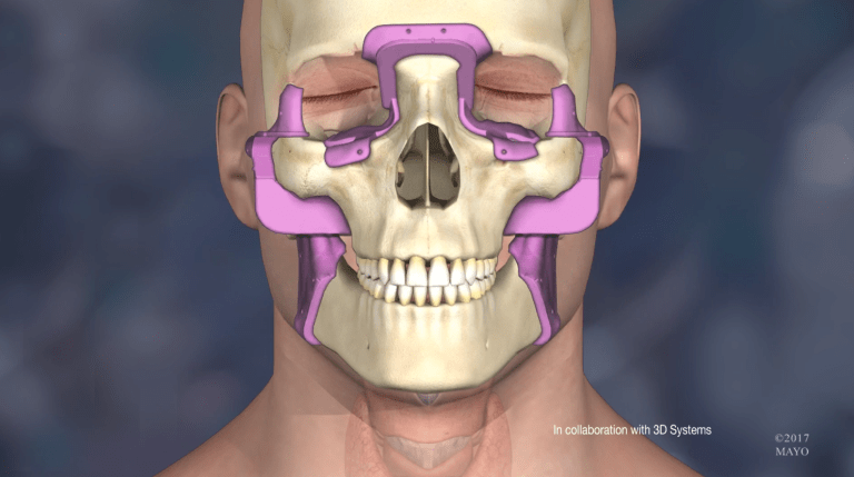 Doctors Gave This Man a New Face